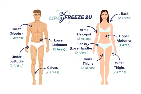 Areas you can have fat freezing treatment Worksop