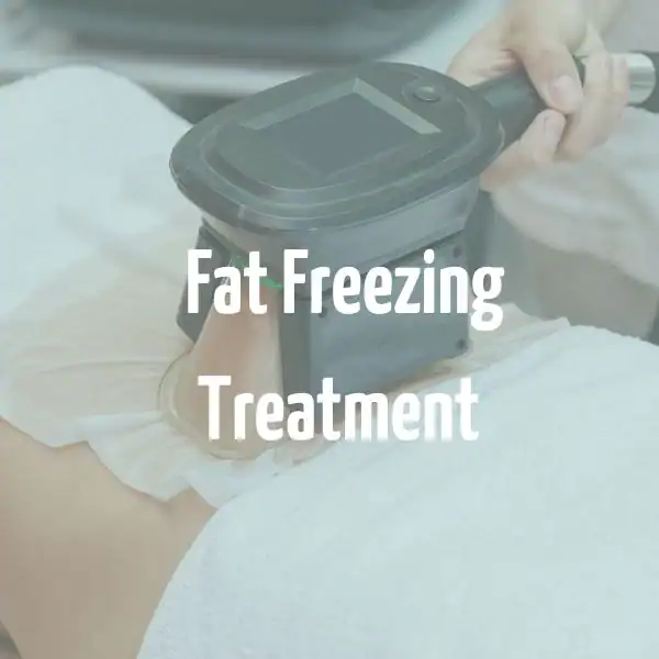 fat freezing treatment Worksop