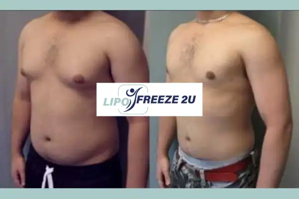 How Long Does It Take to See Results Worksop?