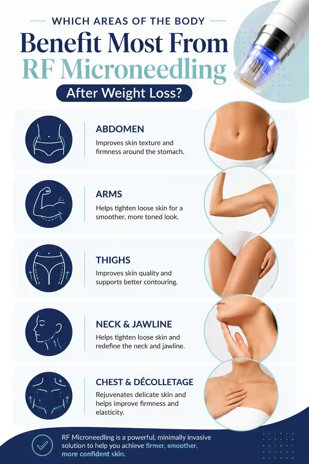 Which Areas of the Body Benefit Most From RF Microneedling After Weight Loss Worksop