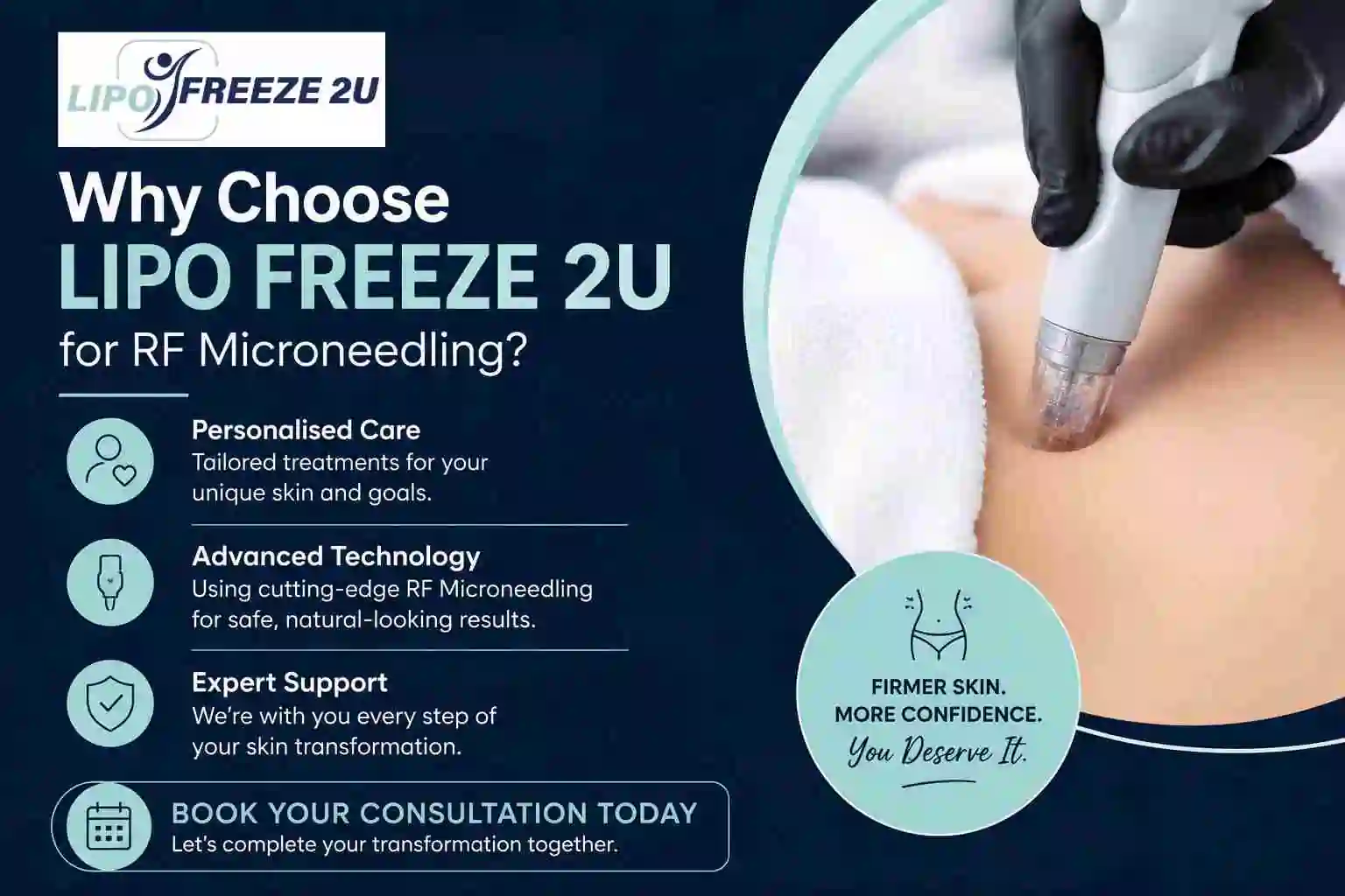Why Choose LIPO FREEZE 2U for RF Microneedling Worksop?